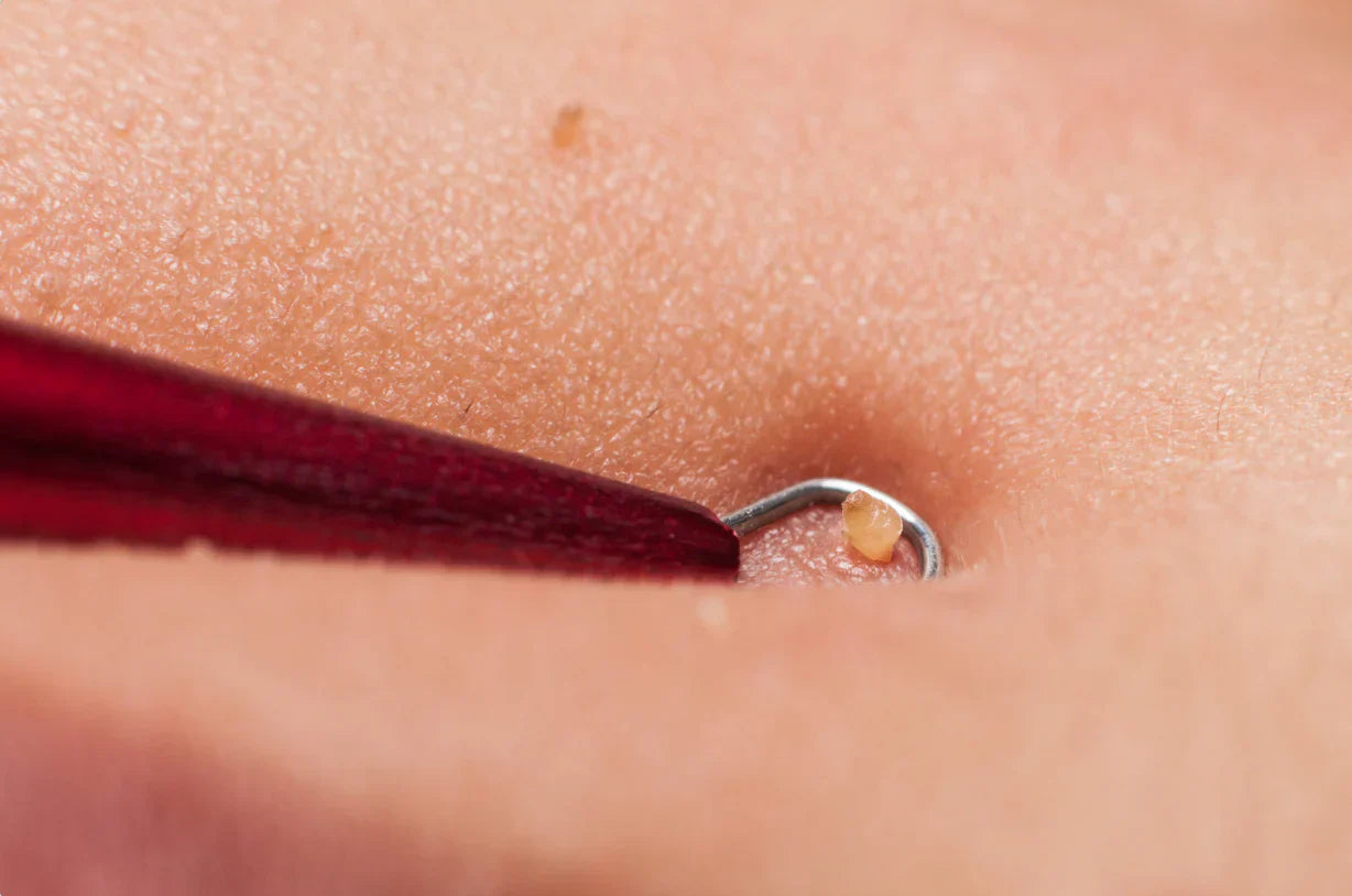 Your Skin Barrier Might Be Making Your Hyperpigmentation Worse