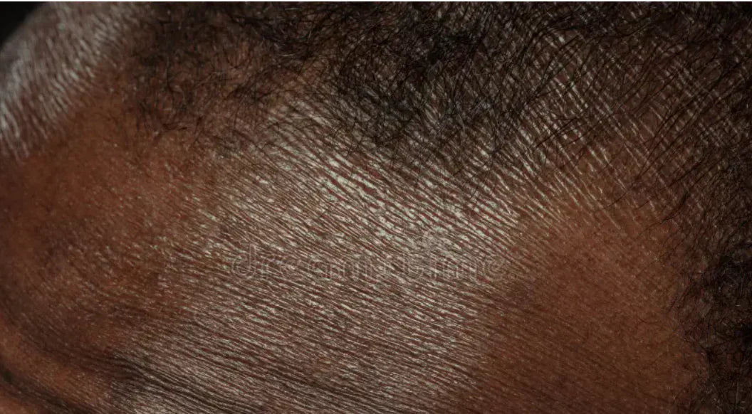 Your Skin Barrier Is the Foundation—Here’s How to Strengthen It
